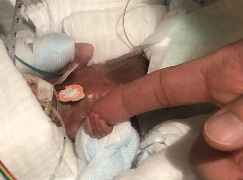 Born weighing 268 grams, the baby boy was kept under intensive care since August