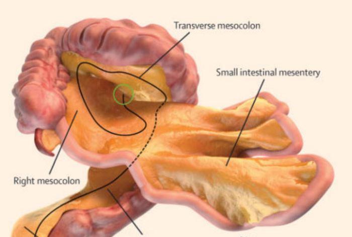 A digital representation of the small and large intestines and associated mesentery J Calvin Coffey, D Peter O’Leary, Henry Vandyke Carter - The Independent