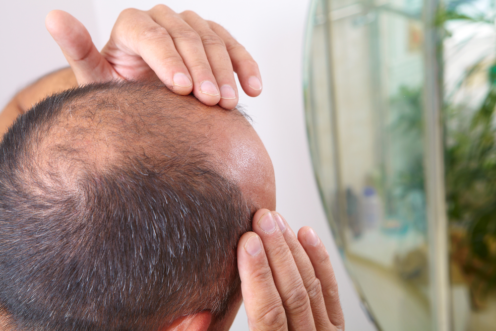 way-316606, a new drug designed to treat osteoporosis can help cure baldness by fighting hair loss and promoting hair growth