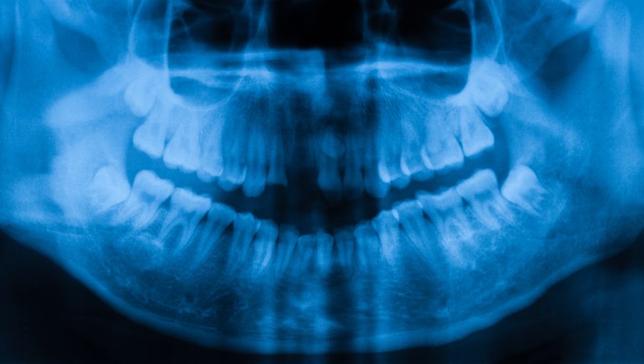 Scientists have found a way to regrow teeth using stem cells and a low-power laser